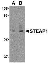 Anti STEAP1 (C-Terminal) Antibody gallery image 1