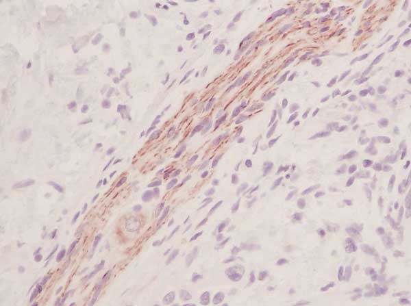 Anti Human Stem Cell Factor Antibody gallery image 1