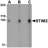 Anti STIM2 Antibody gallery image 1