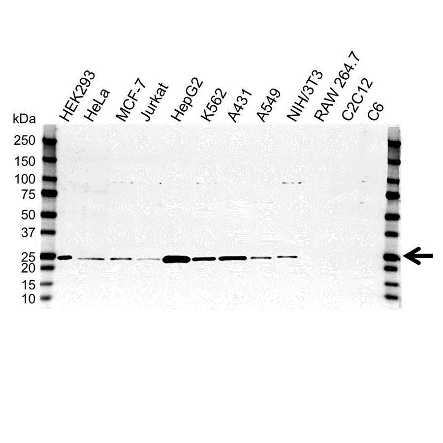 Anti Superoxide Dismutase (MN) Antibody (PrecisionAb Polyclonal Antibody) gallery image 1