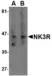 Anti TACR3 Antibody thumbnail image 1