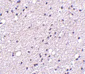 Anti TACR3 Antibody gallery image 2