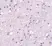 Anti TACR3 Antibody thumbnail image 2