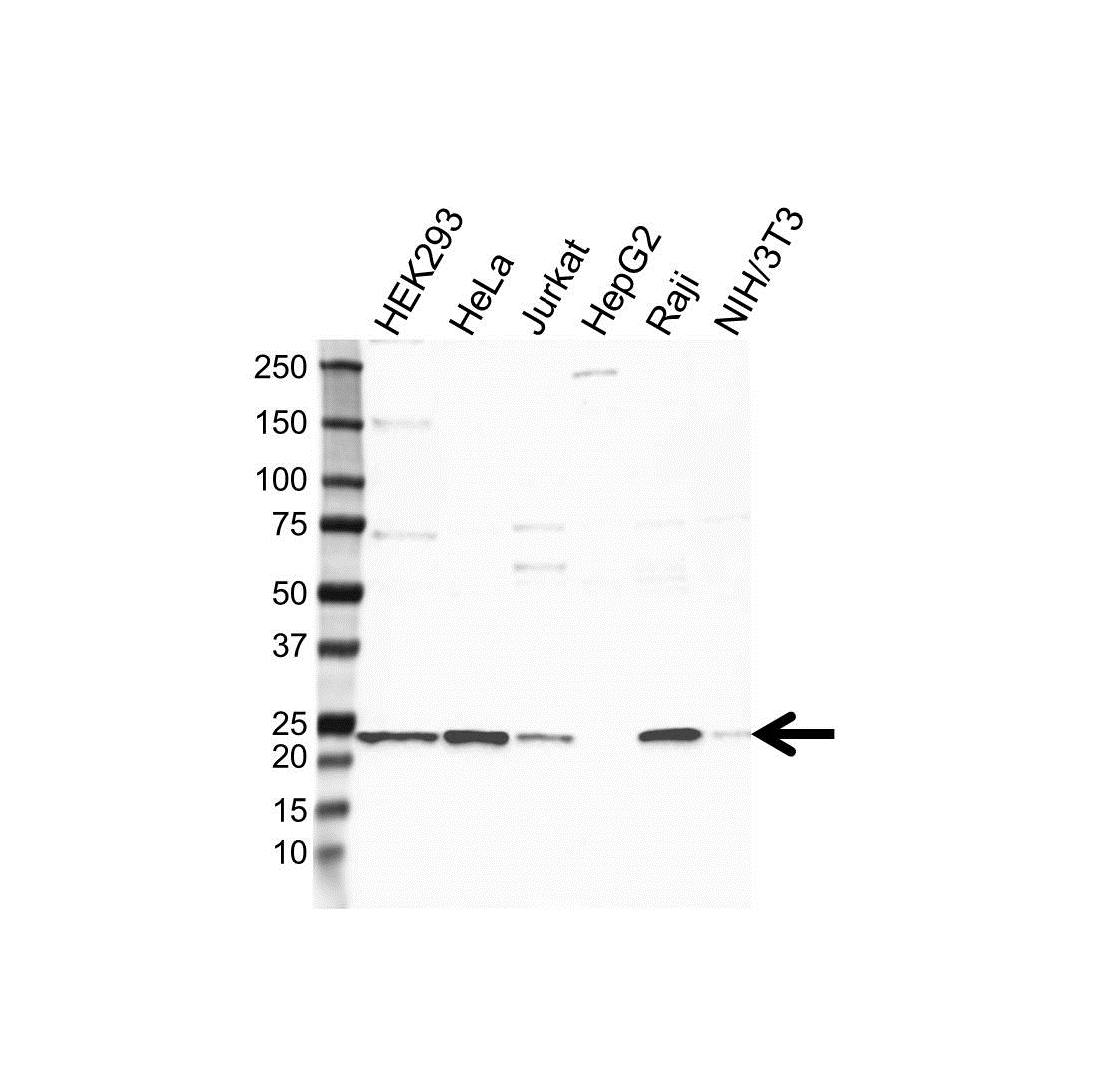 Anti TAGLN2 Antibody (PrecisionAb Polyclonal Antibody) gallery image 1
