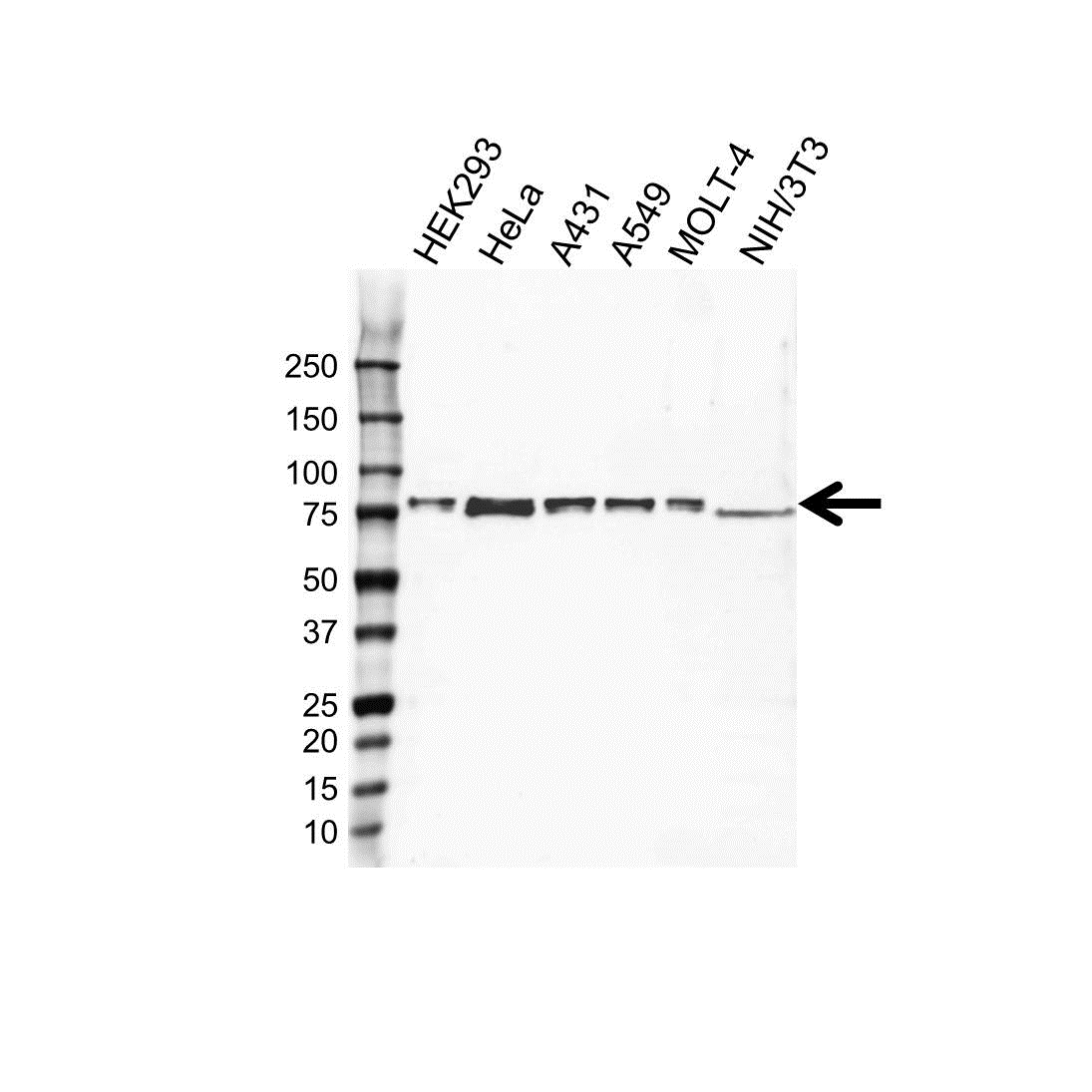 Anti TAK1 Antibody (PrecisionAb Polyclonal Antibody) gallery image 1