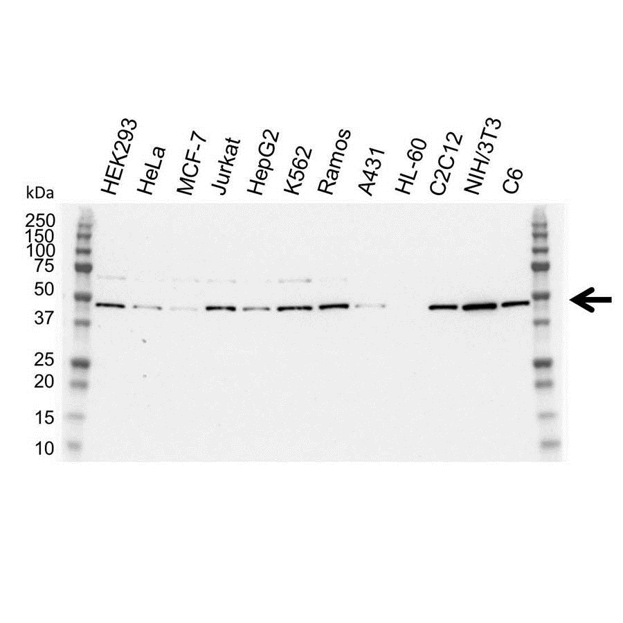 Anti TDP-43 Antibody (PrecisionAb Polyclonal Antibody) gallery image 1