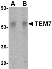 Anti TEM7 Antibody gallery image 1