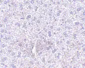 Anti TEM7 Antibody gallery image 2