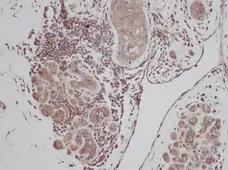 Anti Human TGF Alpha Antibody gallery image 1