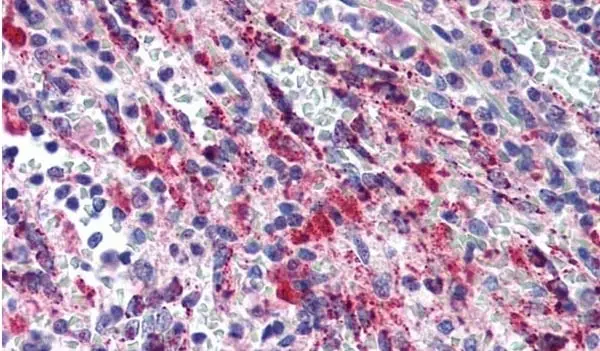 Anti Human TGF Beta Antibody gallery image 2