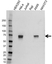 Anti Tgfbi Antibody (PrecisionAb Polyclonal Antibody) thumbnail image 1