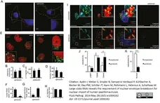 Rabbit Anti Human TGN46 Antibody  gallery image 1