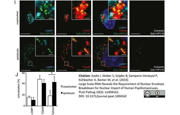 Rabbit Anti Human TGN46 Antibody  gallery image 2