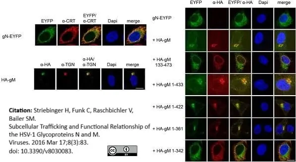 Rabbit Anti Human TGN46 Antibody  gallery image 3