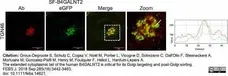 Rabbit Anti Human TGN46 Antibody  gallery image 4