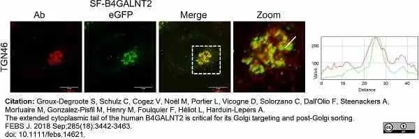 Rabbit Anti Human TGN46 Antibody  gallery image 4