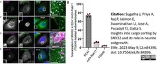 Rabbit Anti Human TGN46 Antibody  gallery image 5