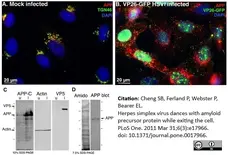 Sheep Anti Human TGN46 Antibody  gallery image 11