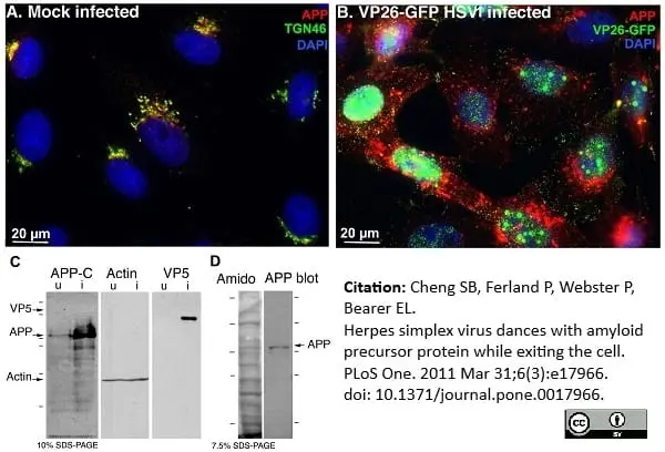 Sheep Anti Human TGN46 Antibody  gallery image 11