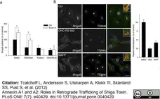 Sheep Anti Human TGN46 Antibody  gallery image 13