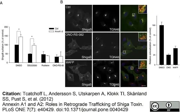 Sheep Anti Human TGN46 Antibody  gallery image 13