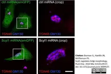 Sheep Anti Human TGN46 Antibody  gallery image 15