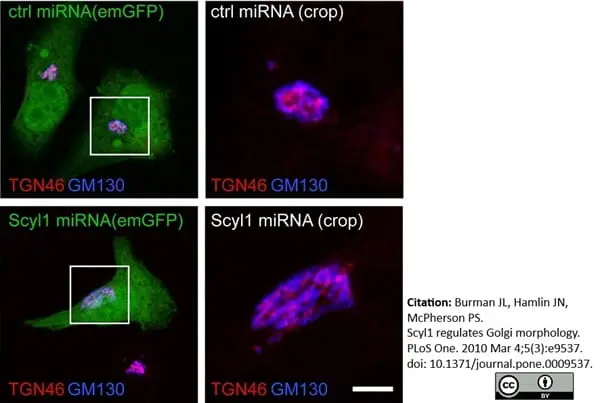 Sheep Anti Human TGN46 Antibody  gallery image 15