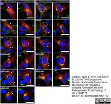 Sheep Anti Human TGN46 Antibody  gallery image 20