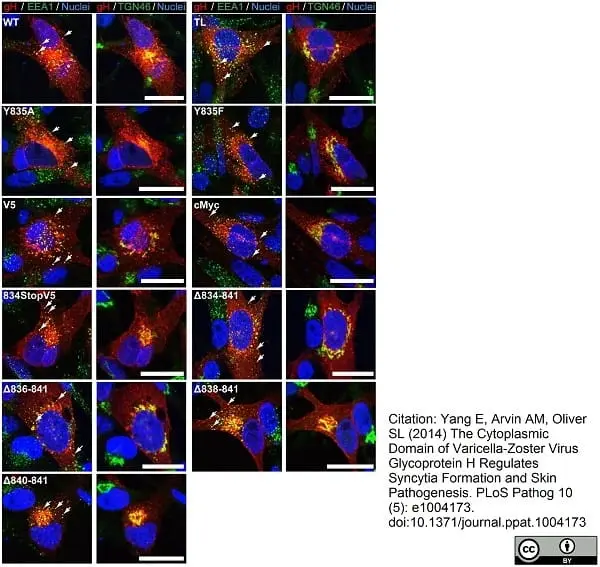 Sheep Anti Human TGN46 Antibody  gallery image 20