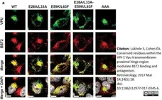 Sheep Anti Human TGN46 Antibody  gallery image 24