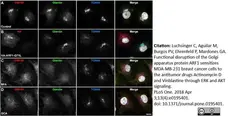 Sheep Anti Human TGN46 Antibody  gallery image 25