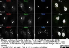 Sheep Anti Human TGN46 Antibody  gallery image 26