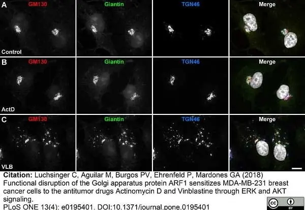 Sheep Anti Human TGN46 Antibody  gallery image 26