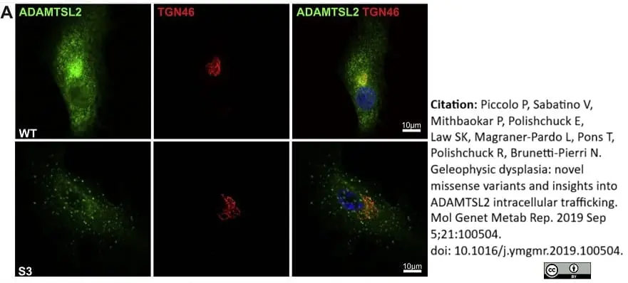 Sheep Anti Human TGN46 Antibody  gallery image 27