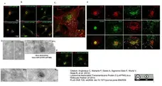 Sheep Anti Human TGN46 Antibody  gallery image 28
