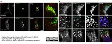 Sheep Anti Human TGN46 Antibody  gallery image 29