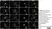 Sheep Anti Human TGN46 Antibody  thumbnail image 31