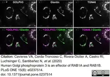Sheep Anti Human TGN46 Antibody  gallery image 33