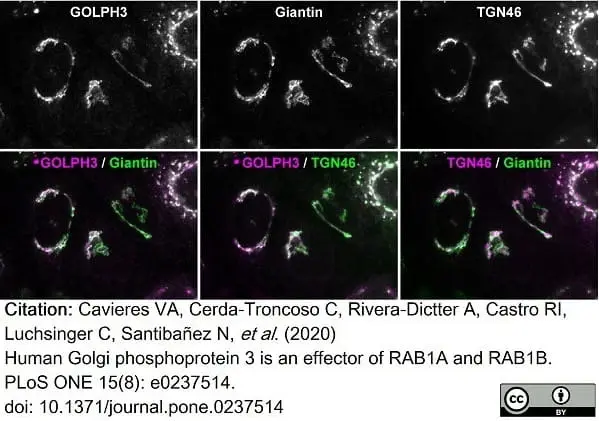 Sheep Anti Human TGN46 Antibody  gallery image 33