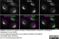 Sheep Anti Human TGN46 Antibody  gallery image 35