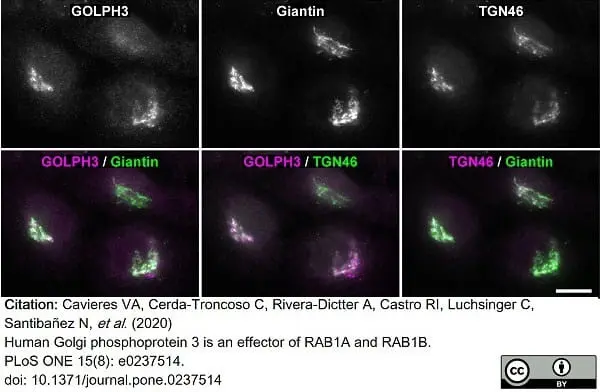 Sheep Anti Human TGN46 Antibody  gallery image 35