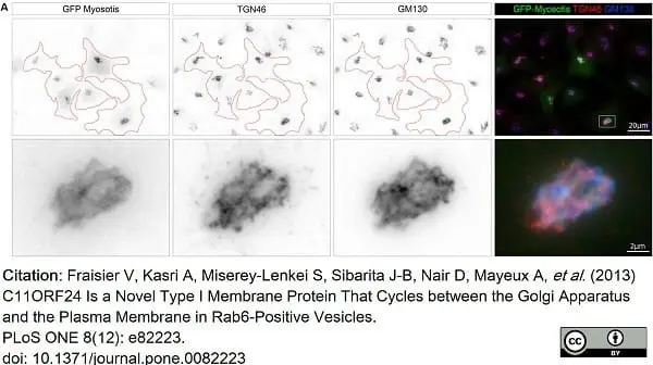 Sheep Anti Human TGN46 Antibody  gallery image 36