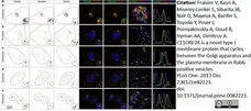 Sheep Anti Human TGN46 Antibody  gallery image 37