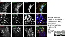 Sheep Anti Human TGN46 Antibody  gallery image 38