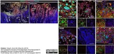 Sheep Anti Human TGN46 Antibody  gallery image 40