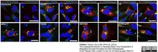 Sheep Anti Human TGN46 Antibody  gallery image 41