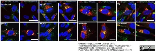 Sheep Anti Human TGN46 Antibody  gallery image 41