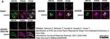 Sheep Anti Human TGN46 Antibody  gallery image 42