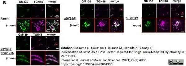 Sheep Anti Human TGN46 Antibody  gallery image 42