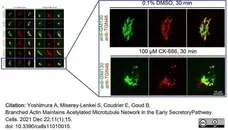 Sheep Anti Human TGN46 Antibody  gallery image 44